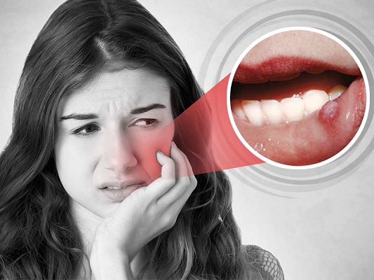 Cuanto Tarda En Desarrollarse Un Cáncer De Páncreas