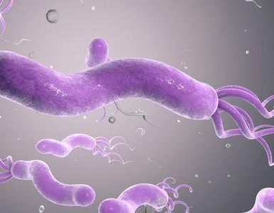 ¿Qué causa la úlcera duodenal?