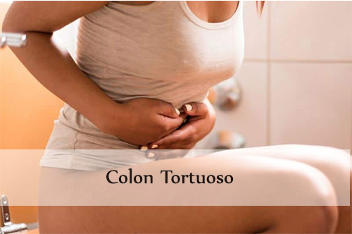 colon tortuoso