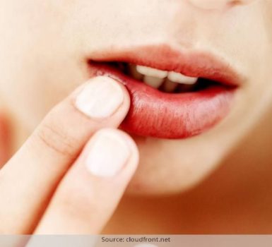 Dolor labial