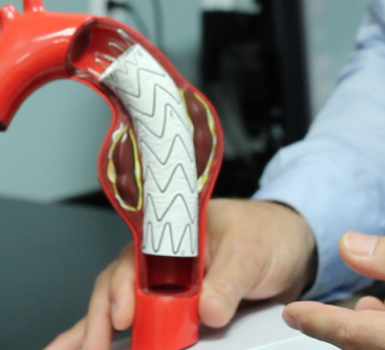 Cuál es la tasa de supervivencia de una disección aórtica