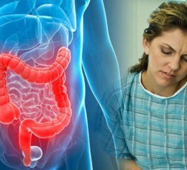 Cuáles son los signos y síntomas de la colitis ulcerosa