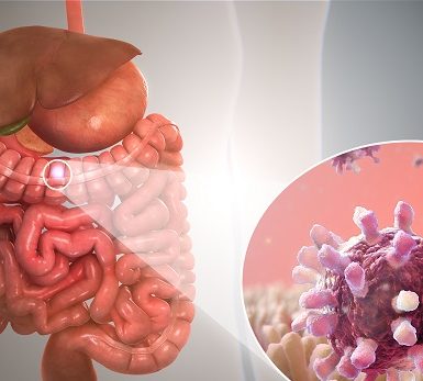 Gastroenteritis o Gripe gástrica o Tummy Bug o Gastro