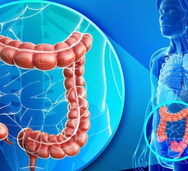 Malrotación intestinal