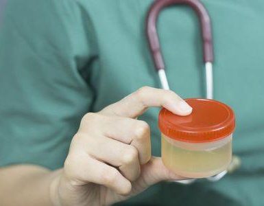 Qué indica la proteína en la orina