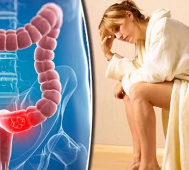 Signos de que el colon no funciona normalmente
