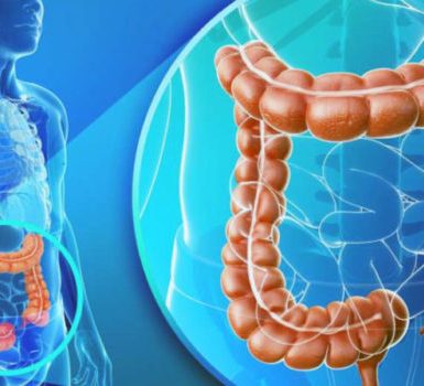 Tratamiento de la colitis ulcerosa