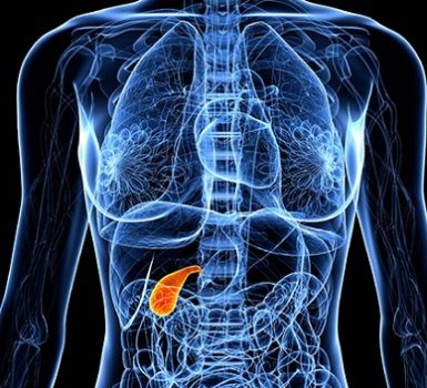 Cáncer de vesícula biliar