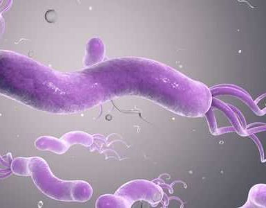 ¿Qué es la úlcera duodenal?