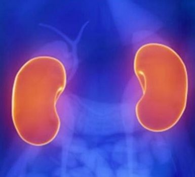 Cómo afecta el lupus a los riñones