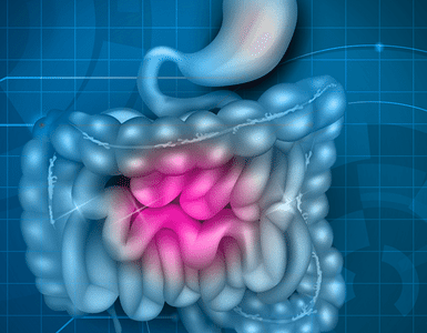 Puede la colitis microscópica convertirse en enfermedad de Crohn