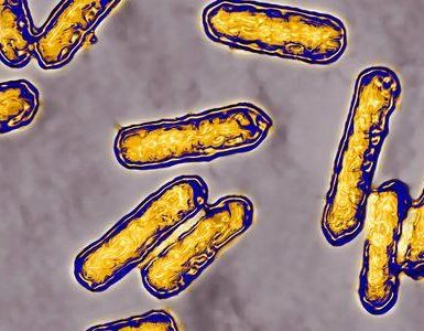 Qué es el brote de listeria