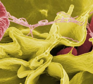 Salmonelosis